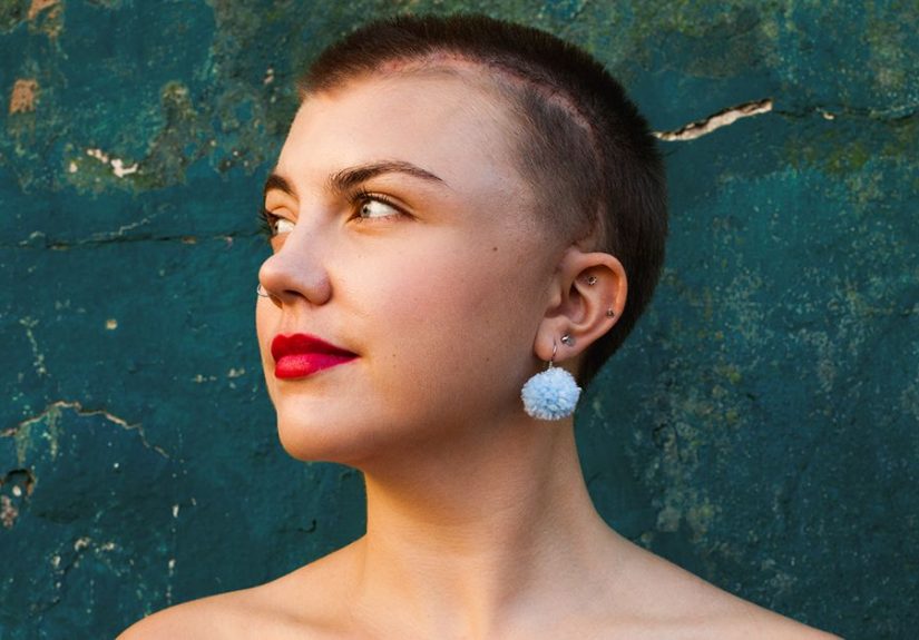 Brain Biopsy Scar: Associated Risks and Recovery