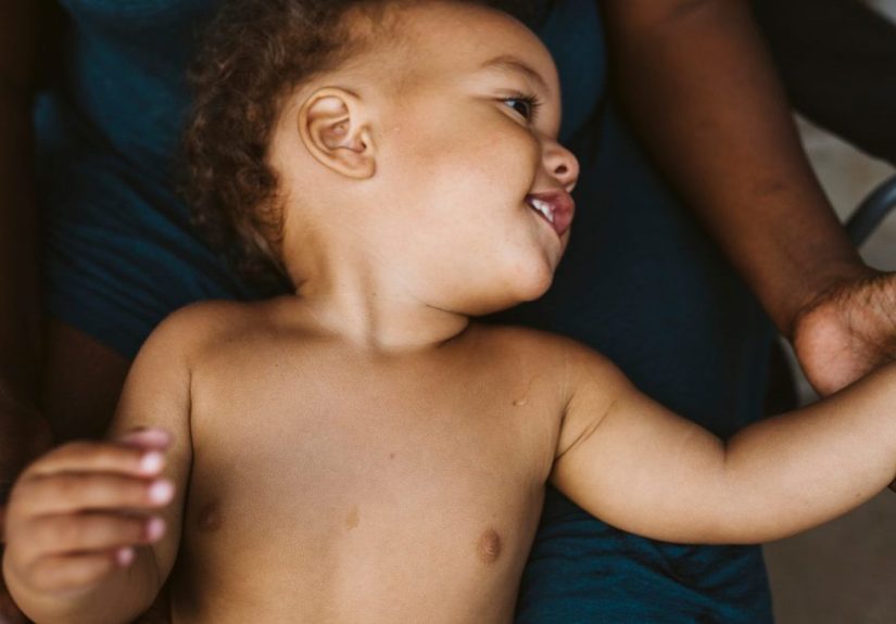 Cold Sore in Babies: Causes, Remedies, and More