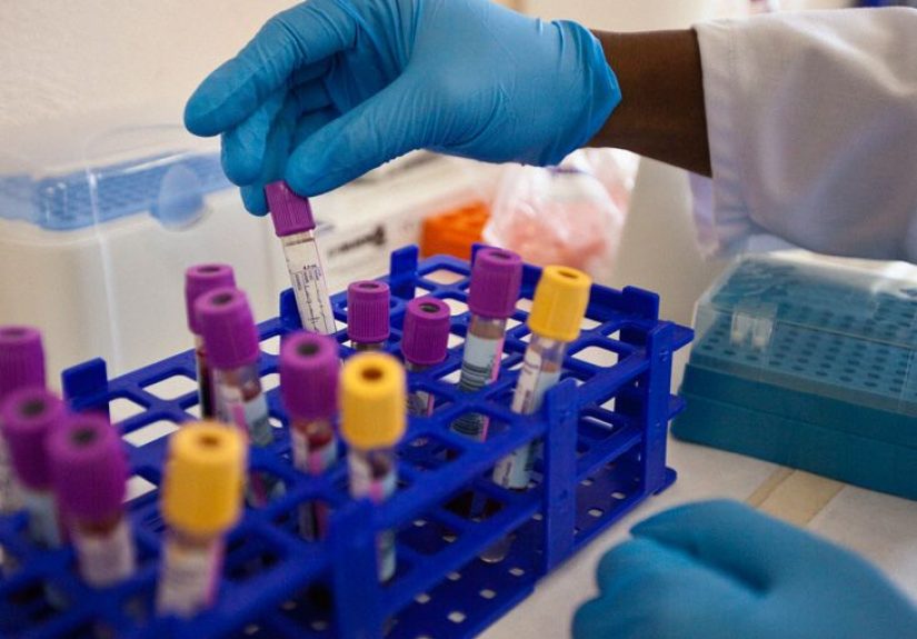 HIV complications: Types, symptoms, and staying healthy