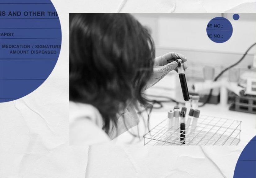 Primary biliary cholangitis: Symptoms, treatment and more