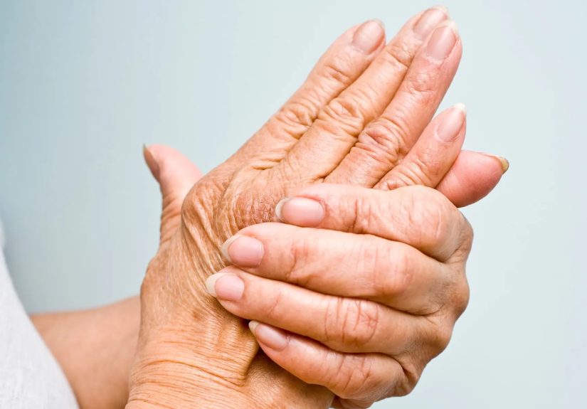 What to Know About Psoriatic Arthritis