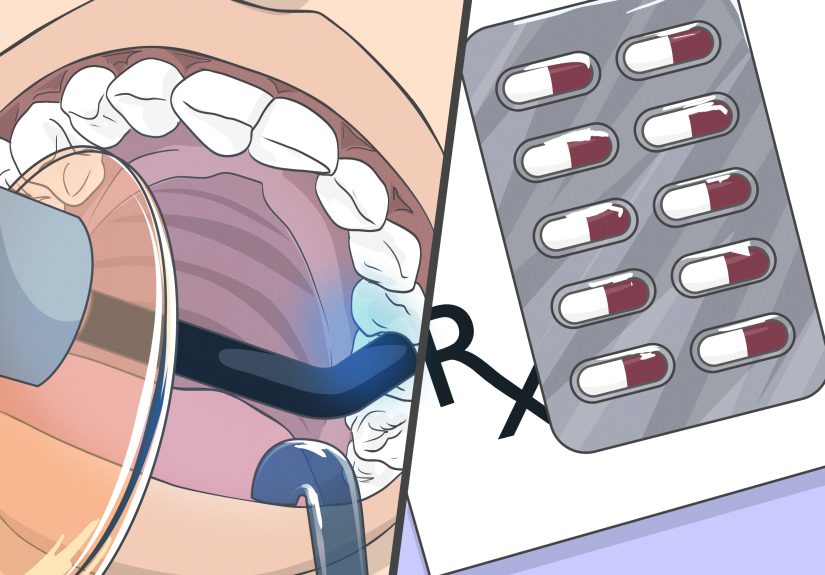 4 Ways to Use Clove Oil for Tooth Pain