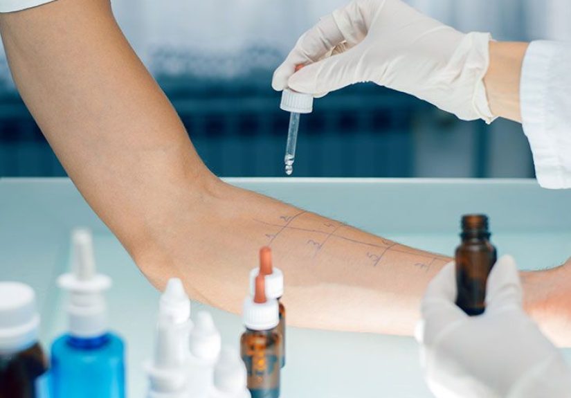 Allergy Testing: Methods and Results