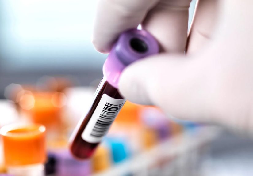 Breakthrough Blood Test for Colorectal Cancer Gets Green Light