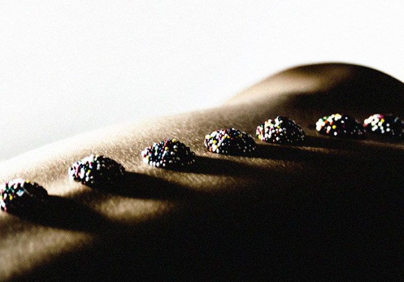 Hyperlordosis: Treatment, Exercises, and Diagnosis