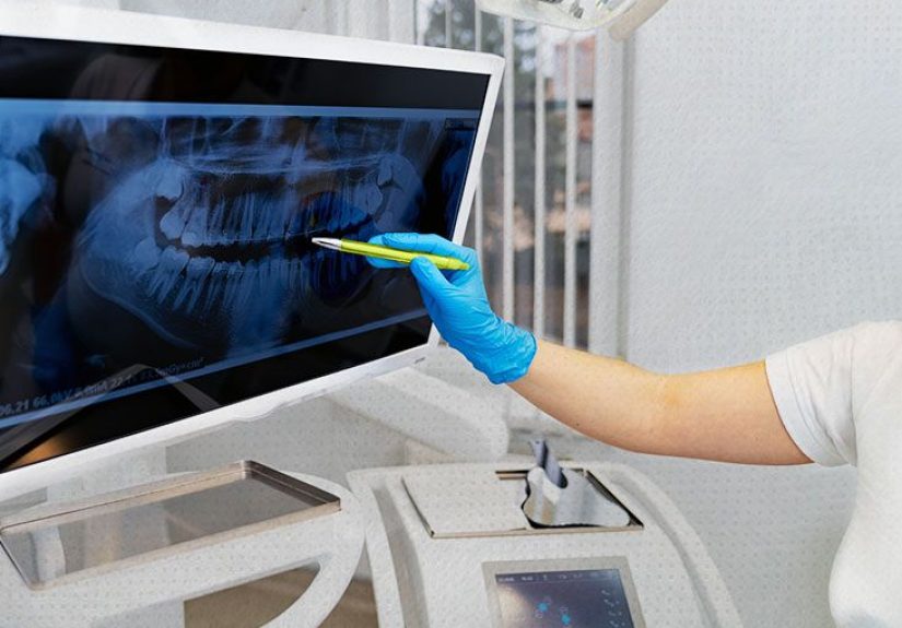 Oral cancer prevention: Lowering the risk and early symptoms