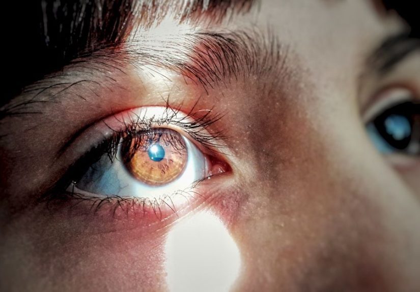 Posterior Vitreous Detachment: Causes, Symptoms, and More