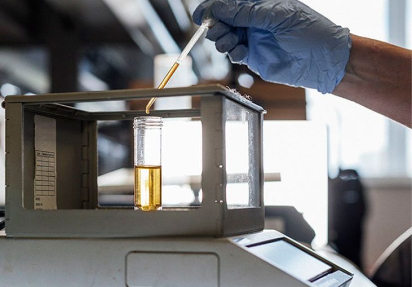 RBC in urine: What it means, ranges, and test results