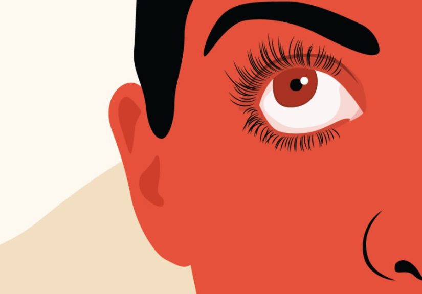 Signs You Need Prescription Treatment for Chronic Dry Eye