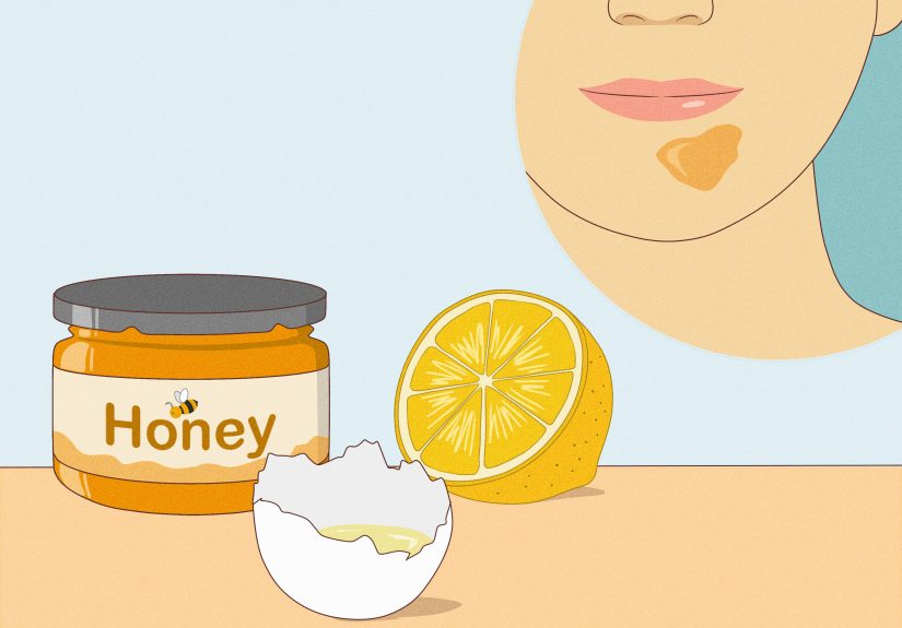 4 Ways to Get Rid of a Blind Pimple Overnight