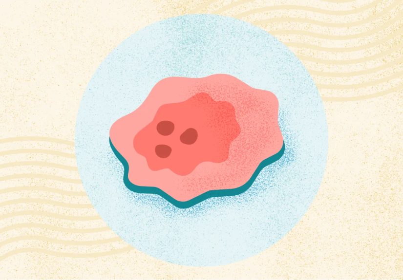 Cancer Risks, Signs, Symptoms, Tests, Treatments, and More