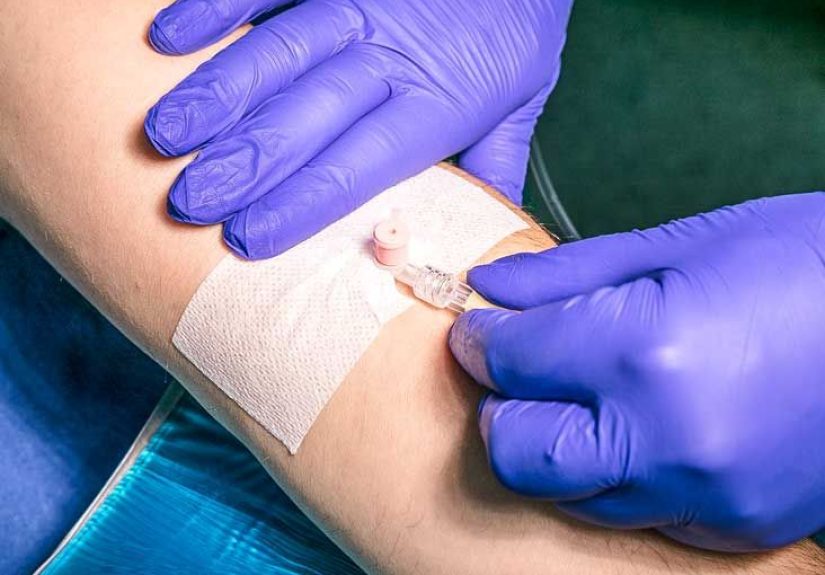 Central Venous Catheters: PICC Lines versus Ports