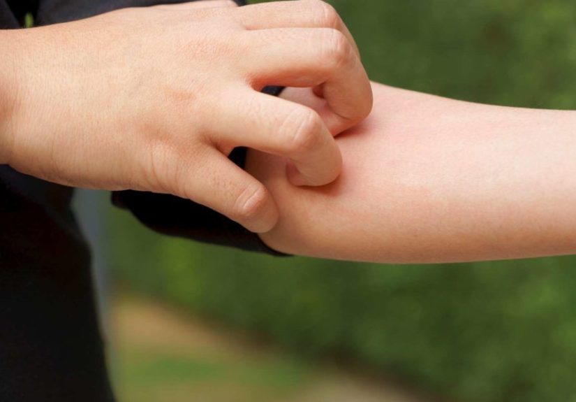 Diabetes and Itching: Causes, Symptoms, and Relief