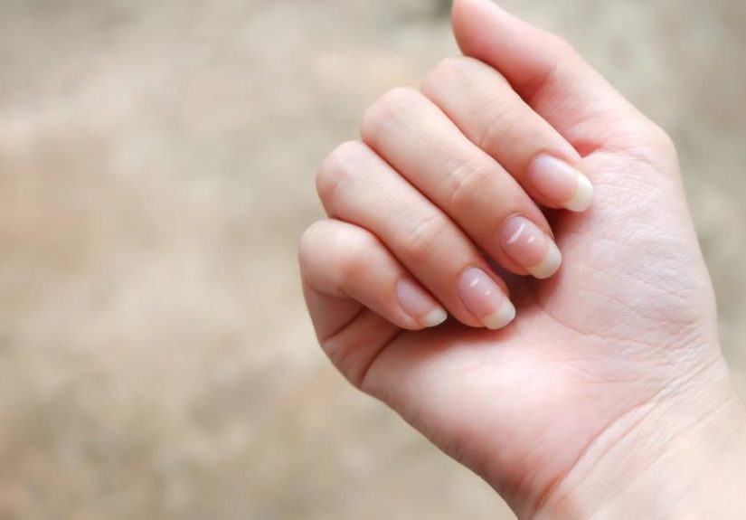 Health Warnings Hidden in Your Nails