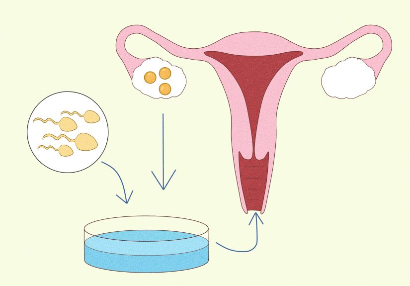 How to Raise Your Chances of Having Twins: 9 Steps
