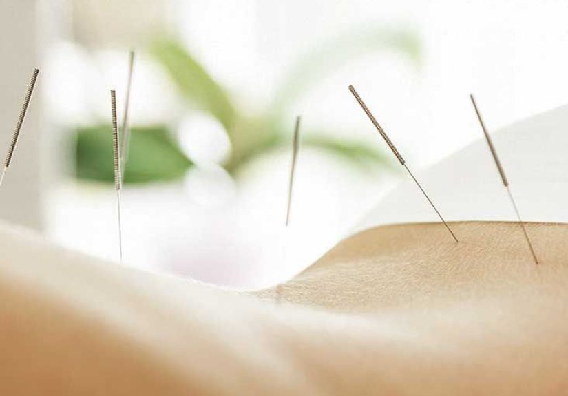 How to Relieve Lower Back Pain