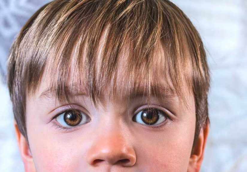 Is Cystic Fibrosis Contagious?