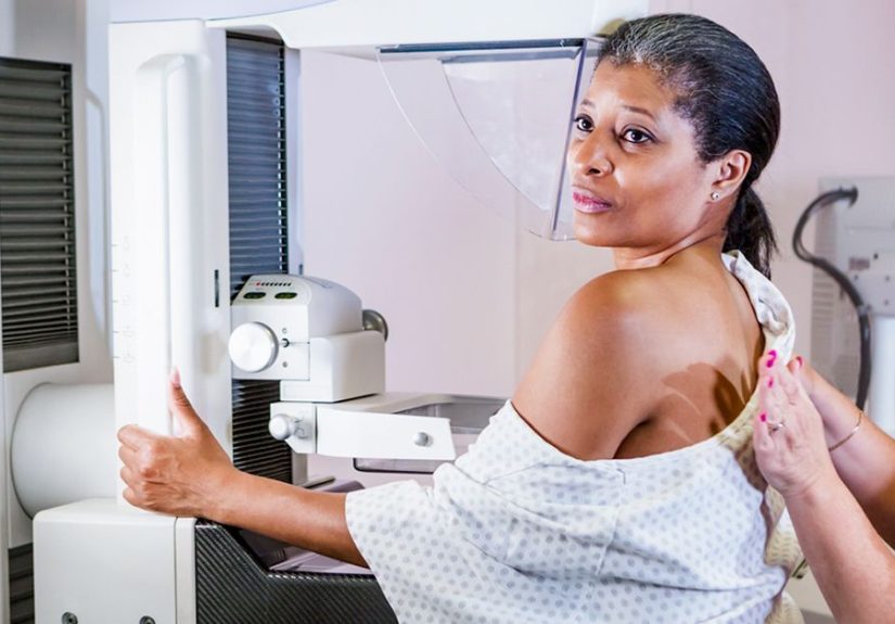 Mammogram: What It Is, Procedure, and More