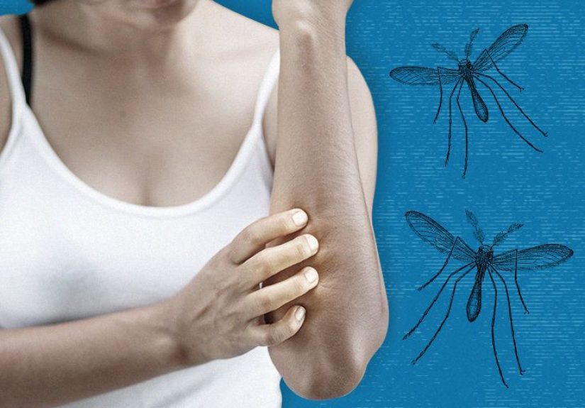 Mosquito bite cream: Options and home remedies