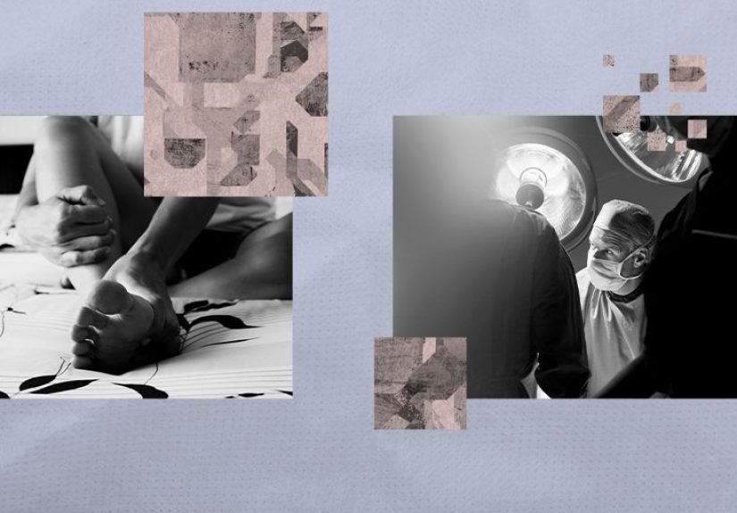 Plantar fasciitis surgery: Goal, procedure, and recovery