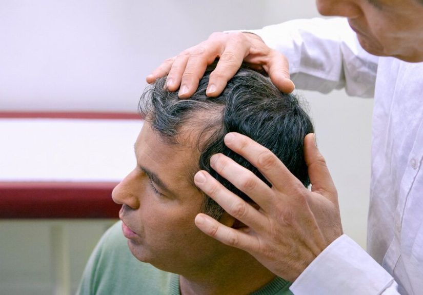 Scalp Eczema: Symptoms, Treatment, Causes, and More