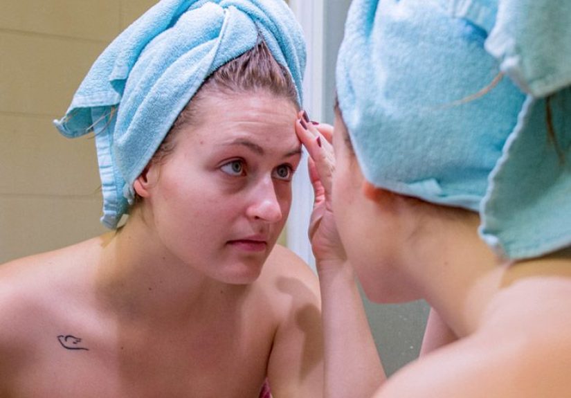 Boil on Skin: Treatment, Causes, and More