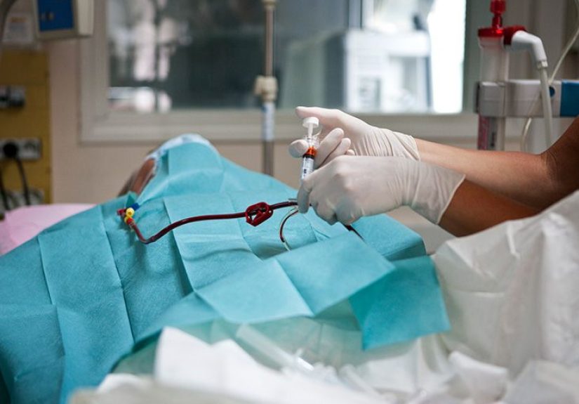 Central venous catheters: Purpose, types, procedure, and more