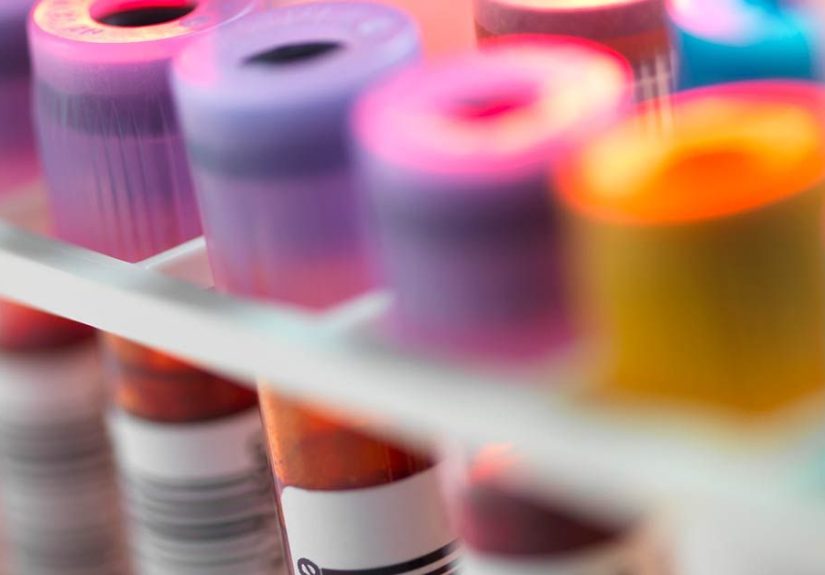 Eclampsia: Causes, Symptoms, and Diagnosis