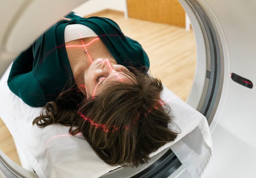 How Accurate are Low Dose CT Scans for Lung Cancer?