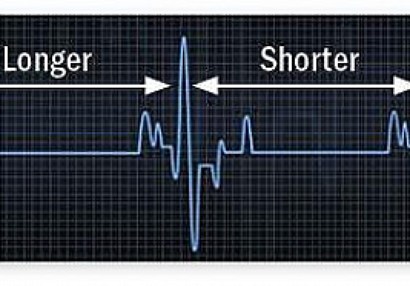 How relevant is heart rate variability? - Harvard Health