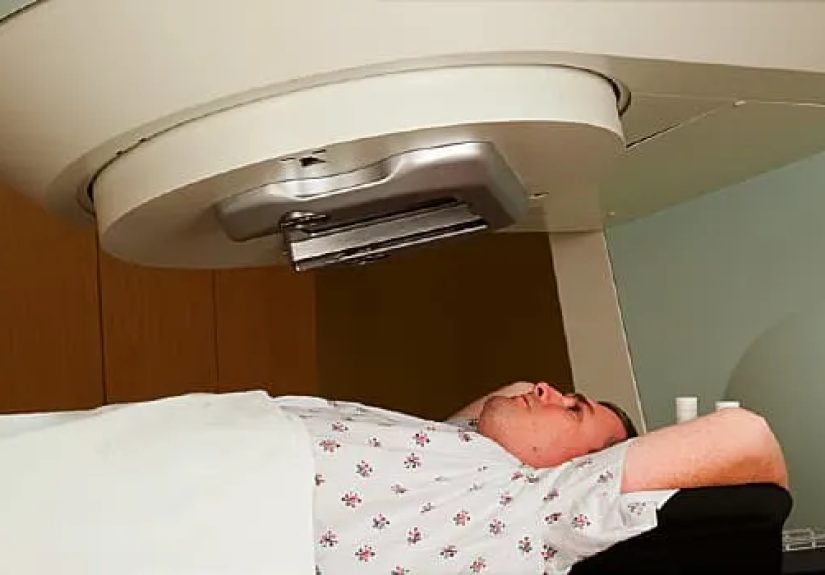 Radiation Therapy for Multiple Myeloma Treatment